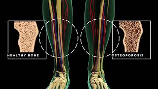 A Look Inside the Body with Life Line Screening [upl. by Akeit]