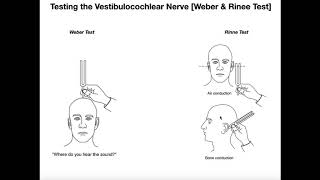 Interpreting the WeberRinne Tests EXPLAINED [upl. by Ahsatsan668]