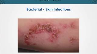 Bacterial skin infections  Dermatology  EduRx [upl. by Tower]