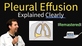 Pleural Effusions  Causes Diagnosis Symptoms Treatment [upl. by Edith]