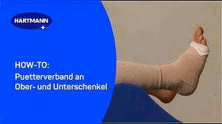 Puetterverband an Ober und Unterschenkel [upl. by Elokin943]