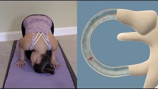 Half Somersault Maneuver to Treat BPPV Vertigo [upl. by Ahsyt]