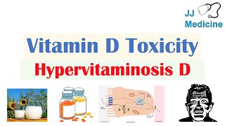 Vitamin D Toxicity Hypervitaminosis D  Causes Pathophysiology Symptoms Diagnosis Treatment [upl. by Ackerley]