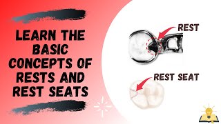 Rests and Rest Seats  The Basics  Removable Partial Denture RPD [upl. by Fleisher352]