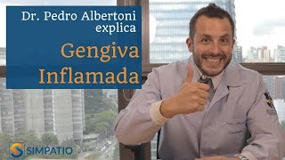 GENGIVA INFLAMADA CAUSAS E TRATAMENTOS com Dr Pedro Albertoni [upl. by Ihskaneem]