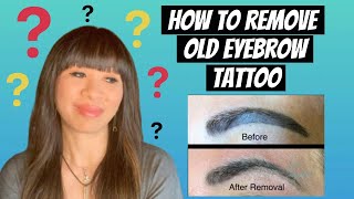 How to Remove Old and Dark Eyebrow Tattoo [upl. by Nihi]